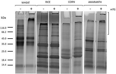 Immunoreactivity of Gluten-Sensitized Sera Toward Wheat, Rice, Corn, and Amaranth Flour Proteins Treated With Microbial Transglutaminase